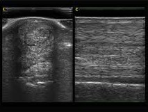 Tendon damage can be seen with ultrasound, sometimes even before swelling or lameness is noticed