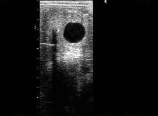 A single pregnancy can be detected at 14 days post breeding